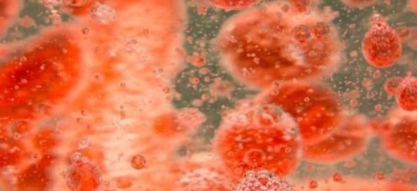 软化血管|喝什么可以预防高血压,高血脂,软化血管?今天来告诉你真相!