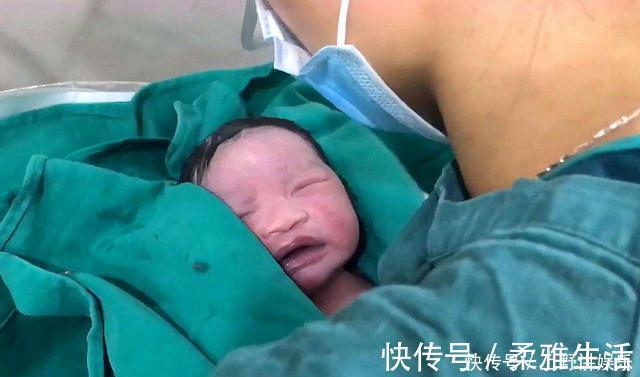 胎脂|新生儿全身涂满“猪油”，母子相见吓坏产妇医生这是好事
