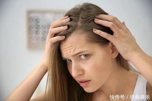 头皮发痒抠出的“白泥”是什么别以为是头皮屑，看看专家怎么说