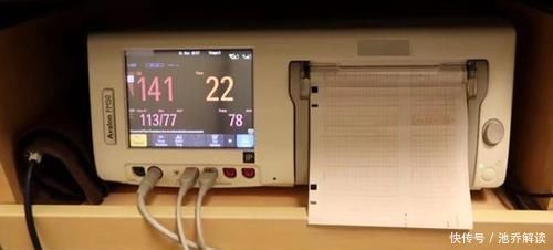过程|最美产妇超快速分娩十指全开到生娃仅用10分钟，老公记录全过程