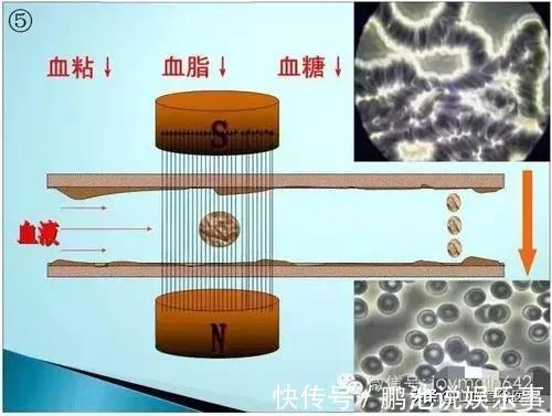 血脂|血液粘稠怎么调理?医生却说,不要再被蒙蔽了