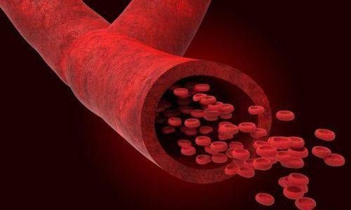 血栓|血液粘稠易患血栓，医生忠言“稀释”血液，就用这两件事足够了