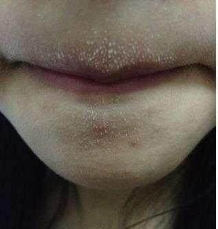 肝脏|身上出现这6个信号，尽快去医院检查一次肝功能，晚了就后悔吧