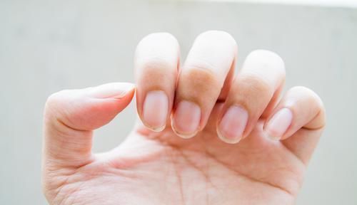 4种指甲的变化,3种情况可要注意,你平时关注过指甲吗