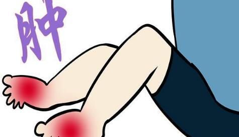 用鸡蛋就可以“祛湿”？湿气重的人，特征明显，稍加留意就可发现