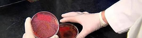 大厨|大厨教你粉条不粘锅又好吃的做法,一学就会,比饭店做的还好吃