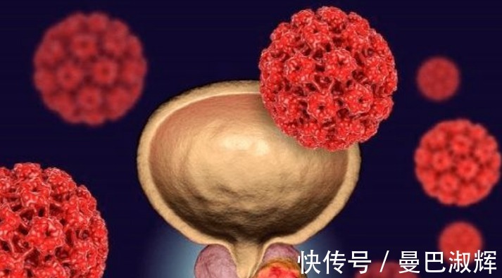 男友|90后情侣双双感染HPV,医生直言,日常2个习惯,劝你戒掉