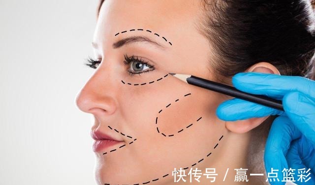 手术 40多岁大姐小拉皮手术全过程分享!