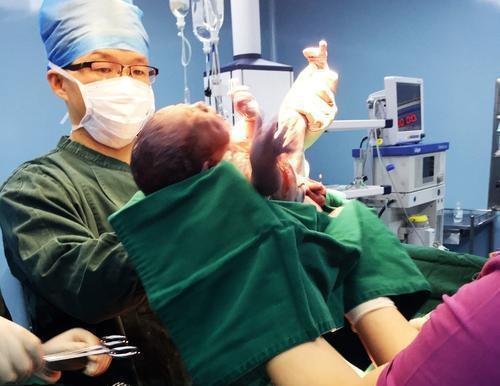 逆袭|90后宝妈生下“包公”宝宝,亲戚们都说丑,三个月后实现“逆袭”