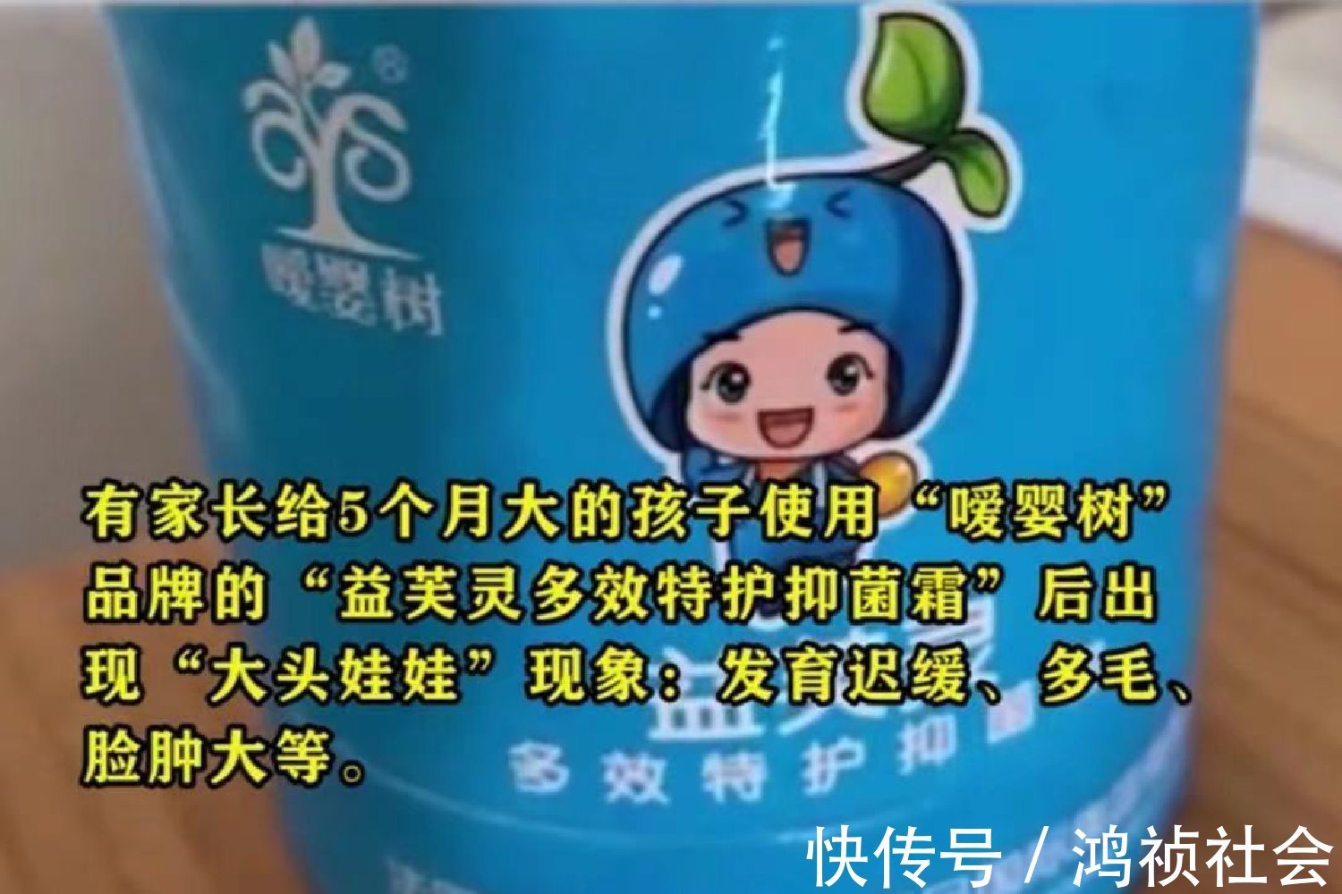 氯倍他索丙酸酯|“大头娃娃”再现,抑菌霜激素超标,致5个月女婴疯狂长胖长毛