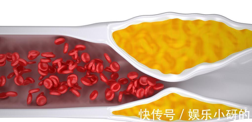 橡膠管|想知道血管堵沒堵，摸摸5個地方就清楚，在家就能做