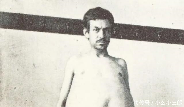 他因便秘离世,身体状况令众人震惊,并成为博