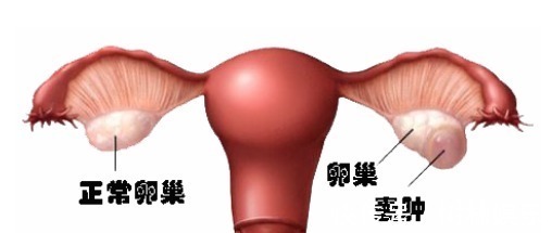 科室|结节、息肉、囊肿、增生哪个最可能癌变这么多年疑惑终于解开了