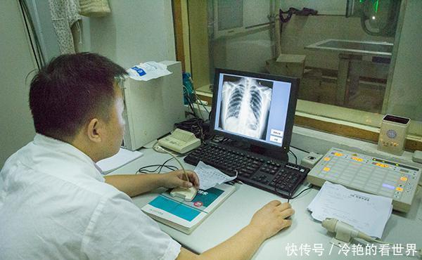 肺部|查出肺结节的人越来越多,根本原因是啥?该怎么处理?一文说清