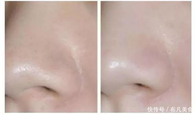 这些医美项目比你们所有的化妆品还有用!