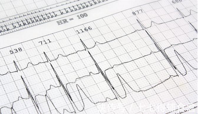 发生率|房颤让卒中风险高好几倍!权威专家教你如何正确对待