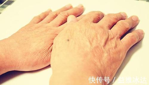 患者|夜间经常手麻,是颈椎病 医生提醒:1种病的可能性更大,勿忽视