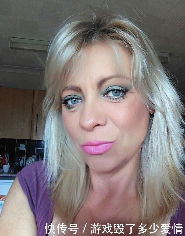 54岁女子贪图便宜,花费2万元在黑市整容,整容后年轻了20岁