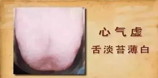 气不足则胖,血不足则瘦