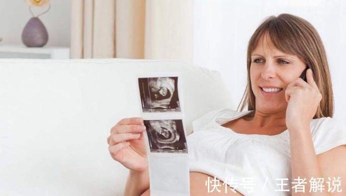 脐带|一听到脐带绕颈四个字,孕妈们就如临大敌,其实起因十分正常