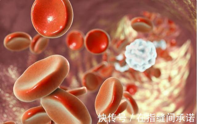 手指|手脚有4个表现，小心血脂已超标，再拖会变心脑血管问题