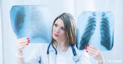 癌细胞|身体没有这3个异常，说明肺部还很健康，肺癌离你很远