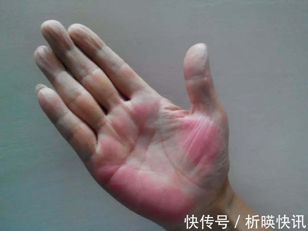 肝脏健康|肝不好的人,会出现5个异常,养肝坚持“三步走”,肝好你更好