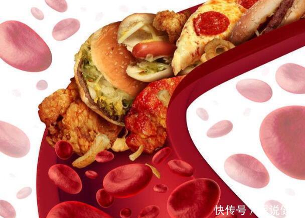 体内有血栓,身体这2处会提前告知,预防血栓要做好这些事