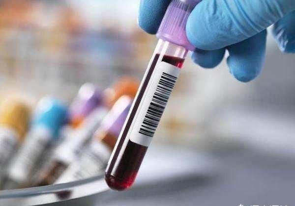 胡吃海|49岁老齐,血脂高到16,医生半年治好;2年后血脂17!什么原因