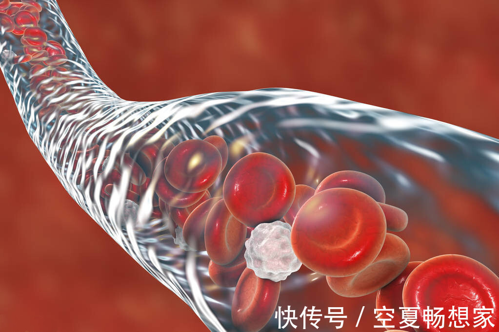 医疗费用|最新研究控制饮食,来降低“坏血脂”,能大大节约医疗费用!