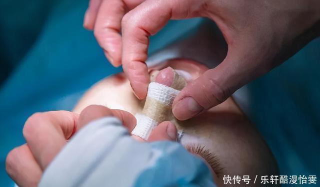 娜娜|被整容毁掉的女孩“我的整形医生,只给鸡腿做过手术”