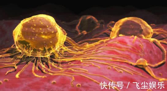 建议|癌症来之前,多会经历"癌前病变",这些实用建议,每一条都重要