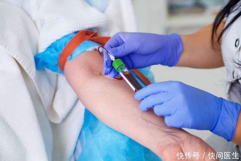 降血脂|高血脂多久检查一次?医生:这2个方法降血脂,血脂想升都难