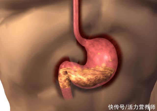 十胃九病|生吃花生米可以养胃？营养师揭秘：适量吃这4种食物都对胃有帮助