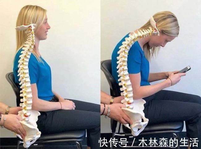 颈椎病|如何摆脱颈椎病疼痛？颈椎病的综合康复治疗，你需要知道！