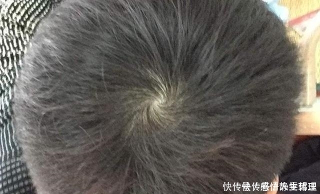 孩子头上的“旋”的个数,暗示孩子智商高低家长要了解真相