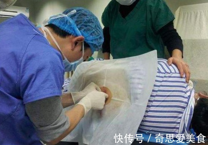 疼痛|生娃时“顺”和“剖”哪个更疼?过来人不想重选,理由值得考量