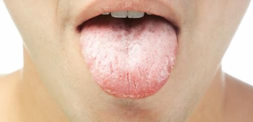瘀斑|从舌望心，你的心有没有问题，看舌就知道了