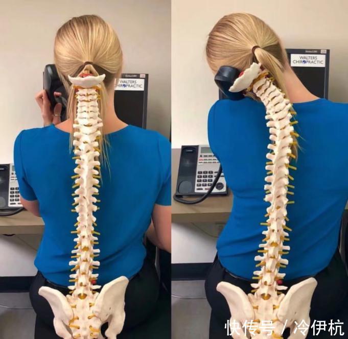 神经根|该怎么治疗颈椎病?这个方法无痛又方便