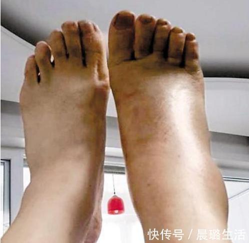 血管健康|血管堵塞的人,早起会有3个表现,若没有,说明血管还算健康