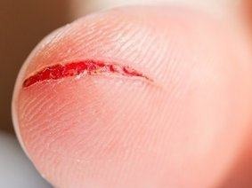 肝脏|身上出现这6个信号,尽快去医院检查一次肝功能,晚了就后悔吧