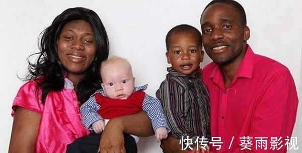 小孩|为什么黑人父母会生出纯白宝宝,不明基因突变