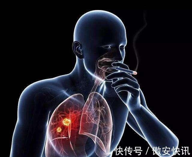 过度肥胖|癌细胞“最怕”5件事！到了45岁，若能坚持做到，长寿或与你有缘
