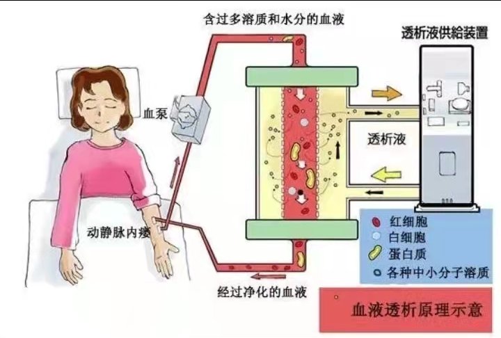 白蛋白尿|远离糖尿病肾病，从您点开这篇文章开始