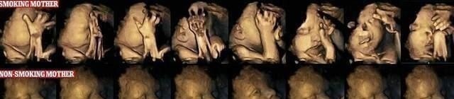 伦琴|做B超前涂的那层黏黏的、凉凉的液体是什么?做完要马上洗掉吗?