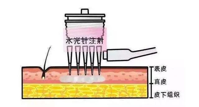 封闭剂|秋冬季科学补水保湿，护肤品中一定不能少了这些成分……