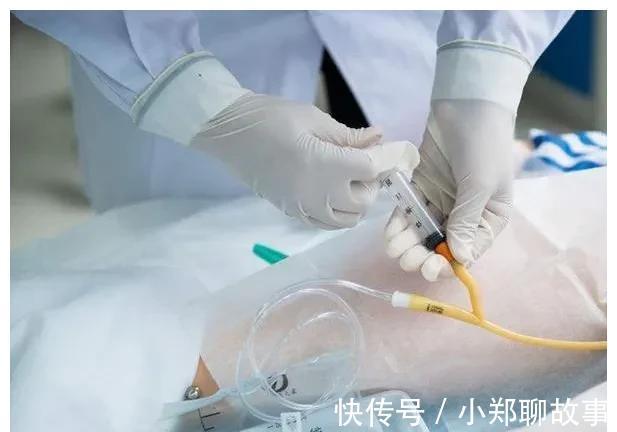 产后抑郁|分娩日记14没有羊水+绕颈两圈,胎盘功能三级,立即插队剖腹产