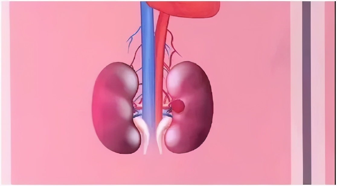 中医|一把黑豆，6味“药”！补肾养血、护血管…但有3类人要慎吃