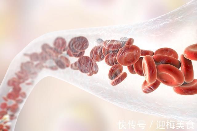 心脑血管|降血脂的“高手”被发现,不是大蒜,你若爱吃,血管干净又年轻