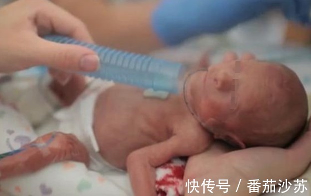 七个月|早产儿“七活八不活”?流传多年的说法,表象与现实有很大偏差
